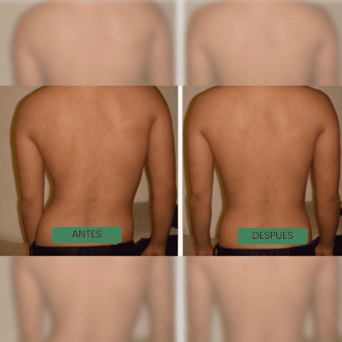 UNDER™ Enderezate y Recupera Tu Confianza